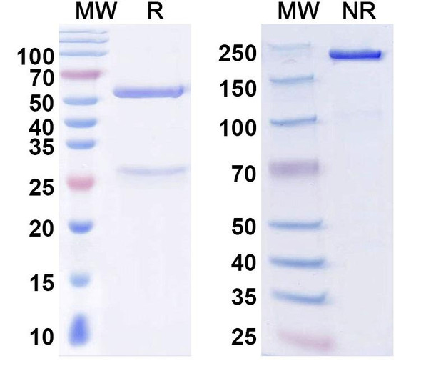 Anti-Norovirus/Norwalk virus Capsid protein VP1/p59 Recombinant Monoclonal Antibody (5I2) - SDS-PAGE
