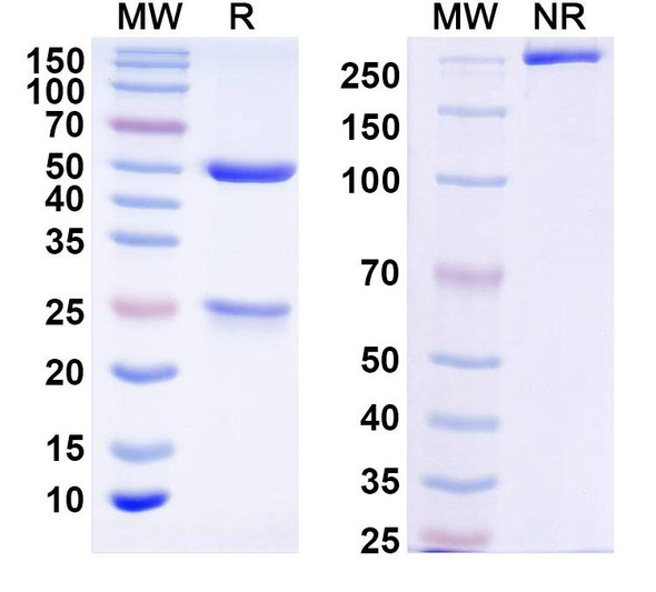 Anti-Human LUM/Lumican Recombinant Monoclonal Antibody (RB130) - SDS-PAGE