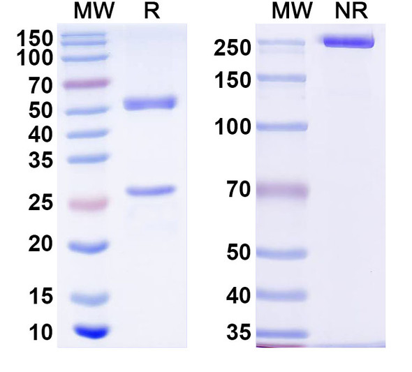 Anti-Human ZBTB41 Recombinant Monoclonal Antibody (C202) - SDS-PAGE