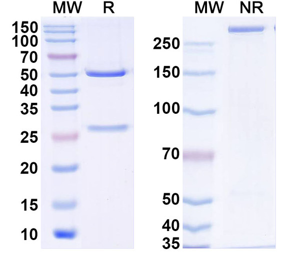 Anti-Human ZGPAT Recombinant Monoclonal Antibody (C186) - SDS-PAGE