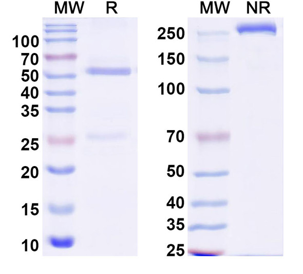 Anti-Human ZKSCAN2 Recombinant Monoclonal Antibody (C204) - SDS-PAGE