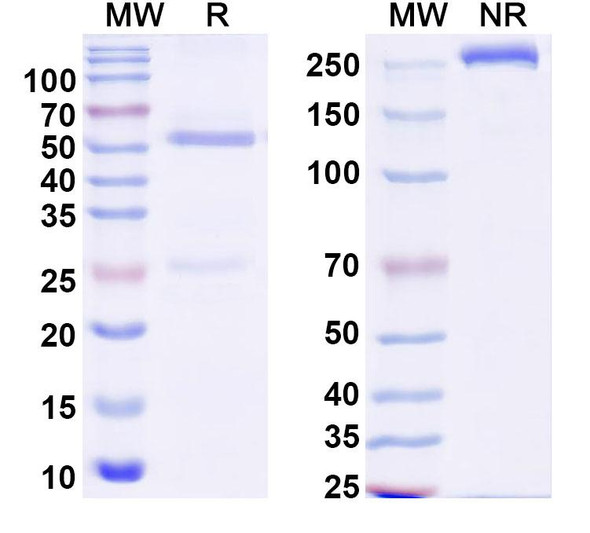 Anti-Human ZKSCAN4 Recombinant Monoclonal Antibody (C198) - SDS-PAGE