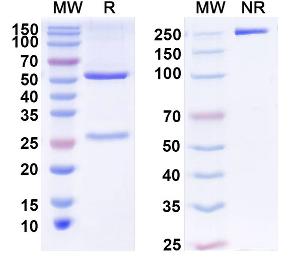 Anti-Human ZKSCAN8 Recombinant Monoclonal Antibody (C50) - SDS-PAGE