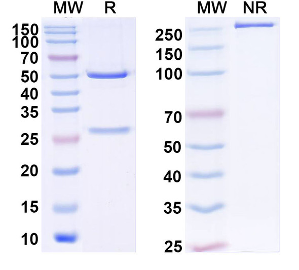 Anti-Human ZNF197 Recombinant Monoclonal Antibody (C209) - SDS-PAGE