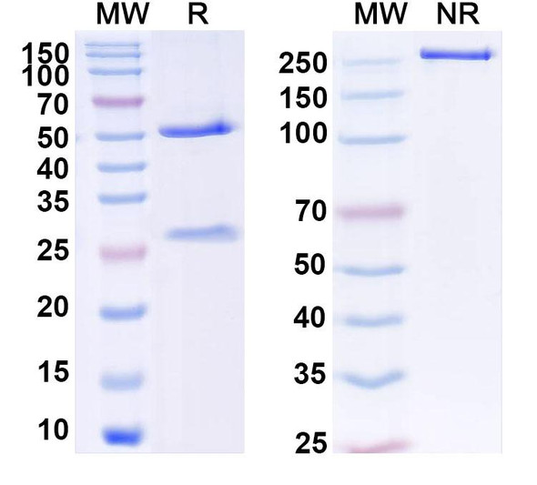 Anti-Human ZNF232 Recombinant Monoclonal Antibody (C473) - SDS-PAGE
