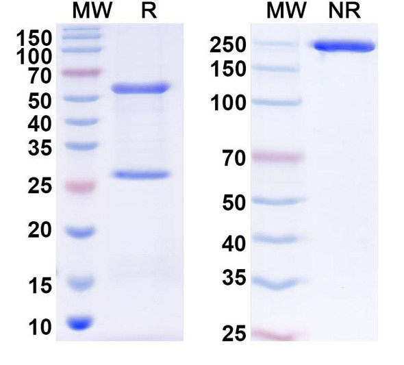 Anti-Human ZNF446 Recombinant Monoclonal Antibody (C26) - SDS-PAGE