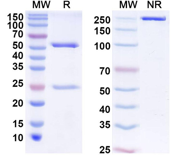 Anti-Human ZNF449 Recombinant Monoclonal Antibody (C474) - SDS-PAGE
