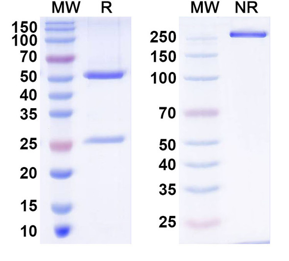 Anti-Human ZNF500 Recombinant Monoclonal Antibody (C257) - SDS-PAGE