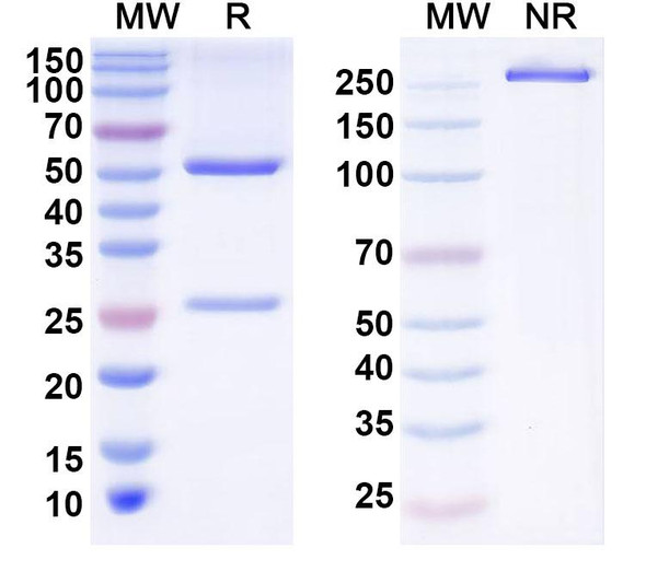 Anti-Human ZNF639 Recombinant Monoclonal Antibody (T10) - SDS-PAGE