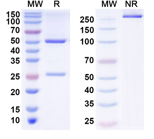 Anti-Human ZSCAN1 Recombinant Monoclonal Antibody (S84) - SDS-PAGE