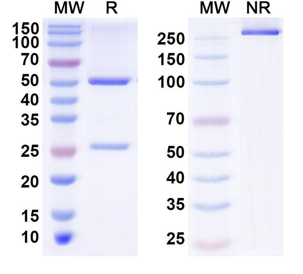 Anti-Human ZSCAN12 Recombinant Monoclonal Antibody (S95) - SDS-PAGE