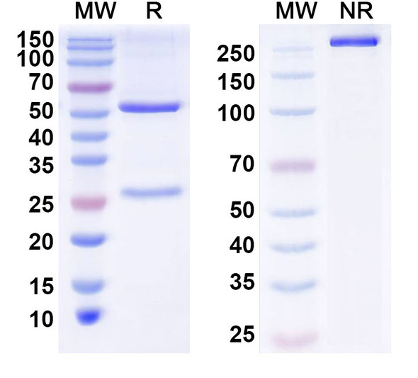 Anti-Human ZSCAN21 Recombinant Monoclonal Antibody (S117) - SDS-PAGE