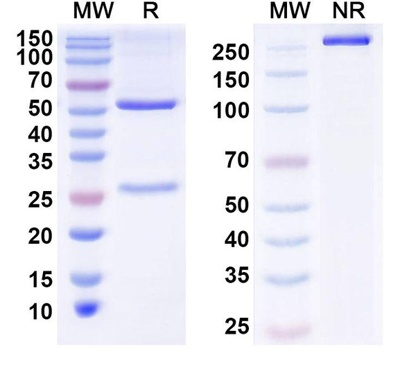 Anti-Human ZSCAN22 Recombinant Monoclonal Antibody (C37) - SDS-PAGE