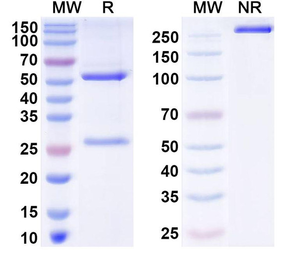 Anti-Human ZSCAN23 Recombinant Monoclonal Antibody (C481) - SDS-PAGE