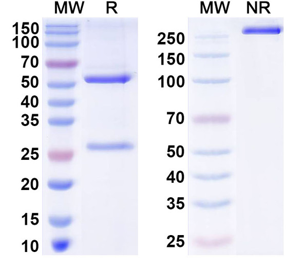Anti-Human ZSCAN23 Recombinant Monoclonal Antibody (C482) - SDS-PAGE