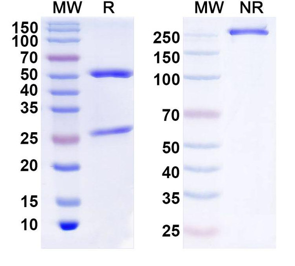 Anti-Human ZSCAN29 Recombinant Monoclonal Antibody (C1) - SDS-PAGE
