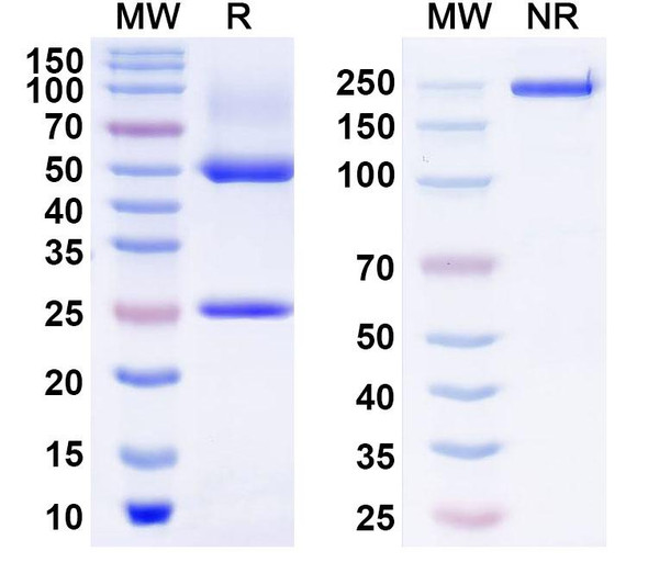 Anti-Human ZSCAN5B Recombinant Monoclonal Antibody (S169) - SDS-PAGE