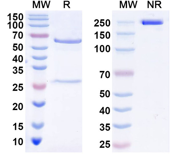Anti-Human ZBTB16 Recombinant Monoclonal Antibody (C243) - SDS-PAGE