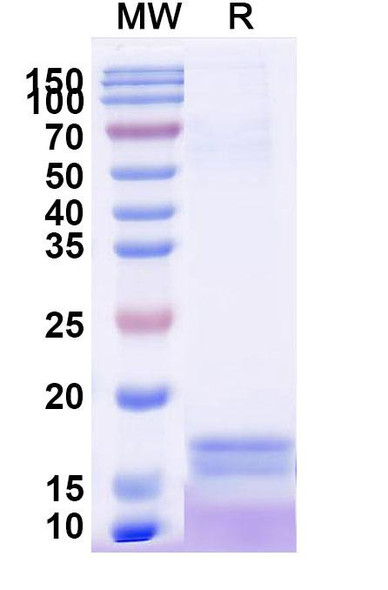 Anti-Human CRP Recombinant Nanobody (SAA2074) - SDS-PAGE