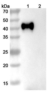 Anti-Human CD38 Recombinant Monoclonal Antibody (HB-7) - WB