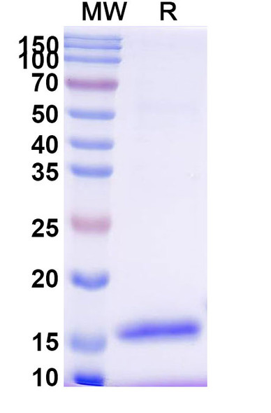 Anti-Human CD8 Recombinant Nanobody (SAA2076) - SDS-PAGE