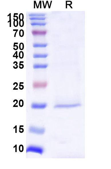 Anti-Human MSLN/Mesothelin Recombinant Nanobody (YE-17) - SDS-PAGE