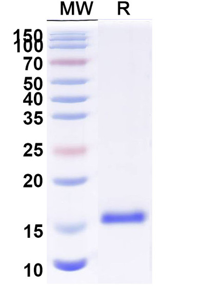 Anti-Mouse CD223/LAG3 Recombinant Nanobody (Clone:3132) - SDS-PAGE