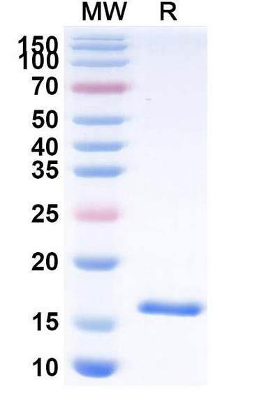 Anti-Human CD16b/FCGR3B Recombinant Nanobody (C28) - SDS-PAGE