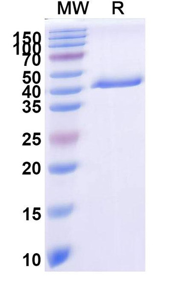 Anti-BVDV Envelope glycoprotein E2 Recombinant Monoclonal Antibody (SAA2086) - SDS-PAGE
