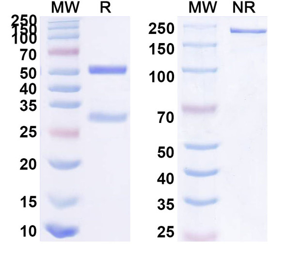 Anti-Human CD121b/IL1R2 Recombinant Monoclonal Antibody (SAA2093) - SDS-PAGE