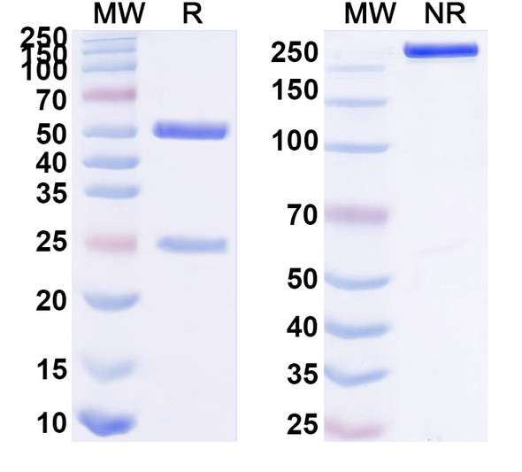 Anti-Human CD121b/IL1R2 Recombinant Monoclonal Antibody (SAA2094) - SDS-PAGE
