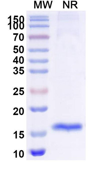 Anti-Human ADAMTS13-cleaved VWF Recombinant Nanobody (KB-VWF-F1.1) - SDS-PAGE