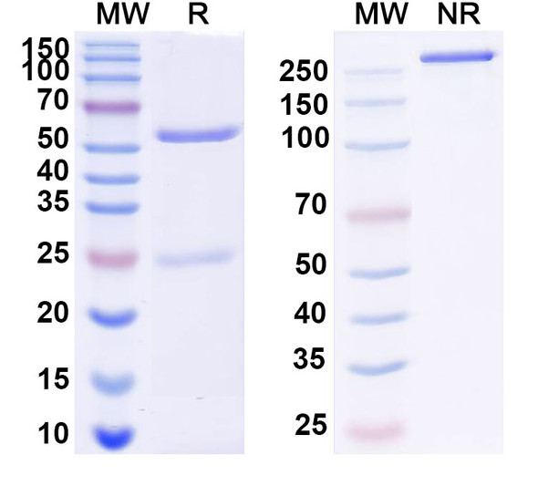 Anti-Human ADAMTS13 Recombinant Monoclonal Antibody (17C7) - SDS-PAGE