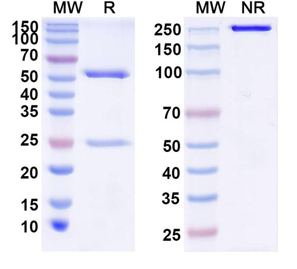 Anti-Human IL38/IL1F10 Recombinant Monoclonal Antibody (IMM20130) - SDS-PAGE