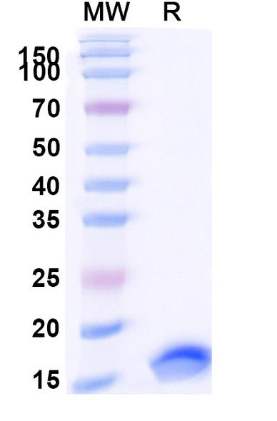 Anti-HHV5/HCMV HHRF3/US28 Recombinant Nanobody (Nb7) - SDS-PAGE