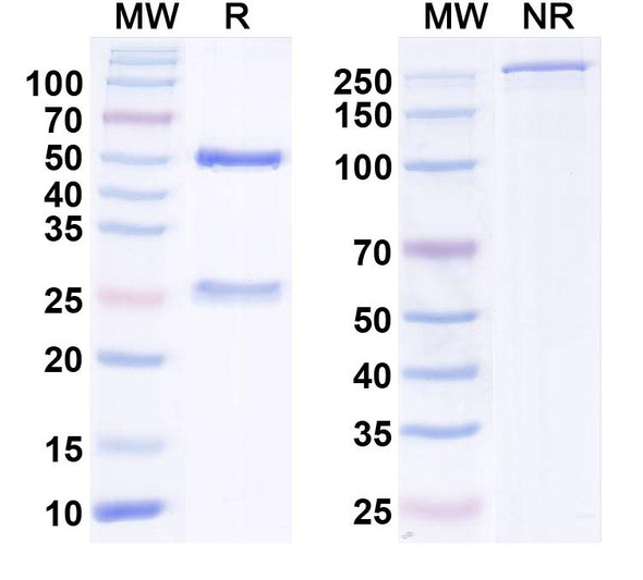Anti-Helicobacter pylori ureA/Urease subunit alpha Recombinant Monoclonal Antibody (HpU-2) - SDS-PAGE