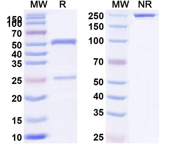 Anti-Helicobacter pylori vacA Recombinant Monoclonal Antibody (N06-D1) - SDS-PAGE