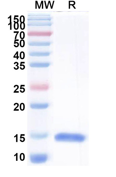 Anti-Helicobacter pylori ureB/Urease subunit beta Recombinant Nanobody (N01-C3) - SDS-PAGE