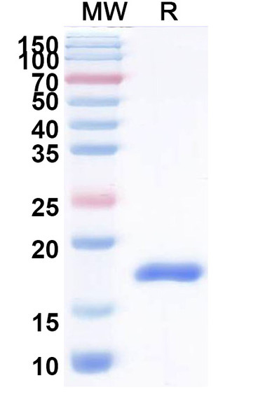 Anti-Helicobacter pylori babA2 Recombinant Nanobody (Nb-ER14) - SDS-PAGE
