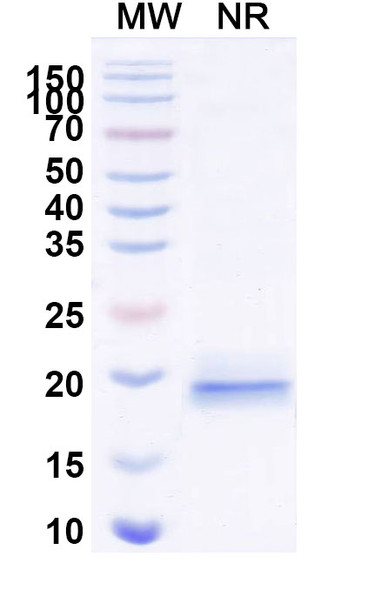 Anti-Helicobacter pylori ureC/glmM Recombinant Nanobody (HMR23) - SDS-PAGE