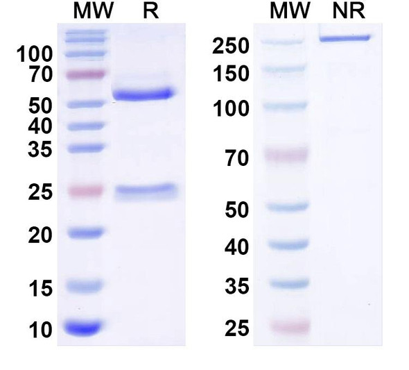 Anti-Human ESR1/ER-alpha Recombinant Monoclonal Antibody (RB133) - SDS-PAGE