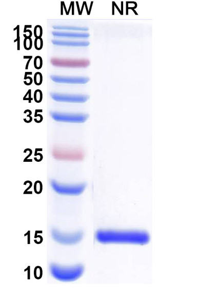 Anti-Human CD112/Nectin-2/PVRL2 Recombinant Nanobody (SAA2117) - SDS-PAGE