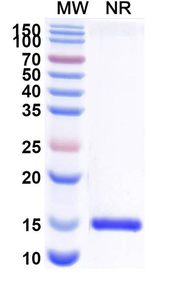 Anti-Human CD112/Nectin-2/PVRL2 Recombinant Nanobody (SAA2117) - SDS-PAGE