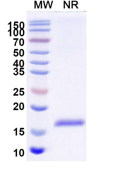 Anti-Human CD112/Nectin-2/PVRL2 Recombinant Nanobody (SAA2117) - SDS-PAGE