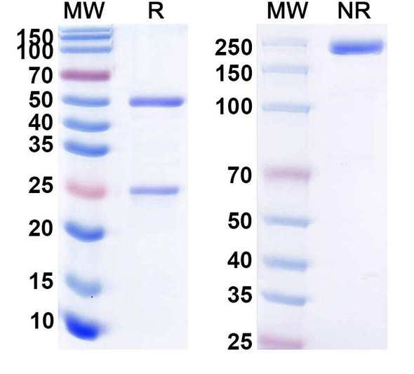 Anti-Human ANKZF1 Recombinant Monoclonal Antibody (SAA2126) - SDS-PAGE