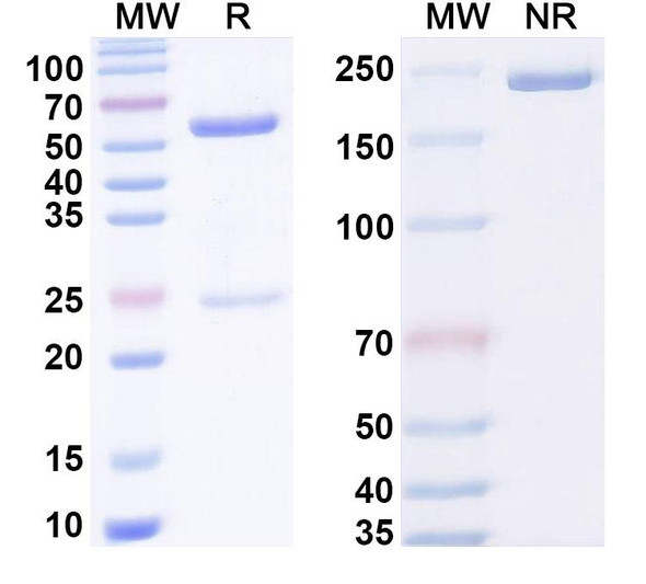 Anti-Human CBX2 Recombinant Monoclonal Antibody (SAA2130) - SDS-PAGE