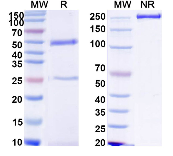 Anti-Human CBX3 Recombinant Monoclonal Antibody (SAA2131) - SDS-PAGE