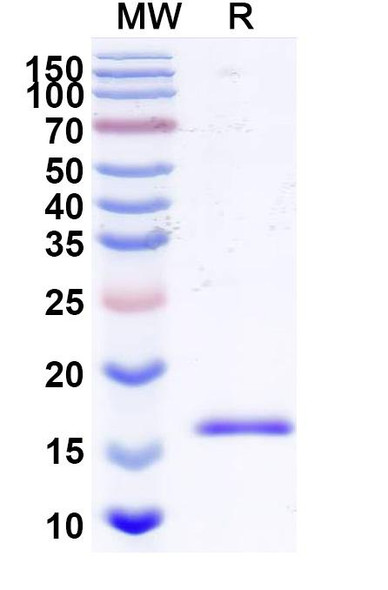 Anti-Human BAX Recombinant Nanobody (SAA2133) - SDS-PAGE