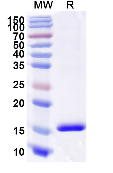 Anti-Human CD89/FCAR1 Recombinant Nanobody (SAA2151) - SDS-PAGE
