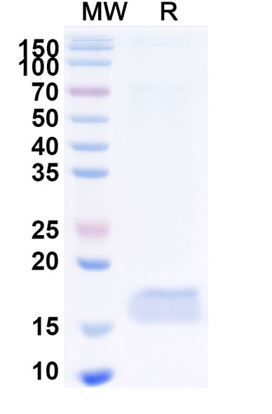 Anti-Human CD89/FCAR1 Recombinant Nanobody (SAA2151) - SDS-PAGE